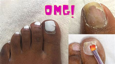 polygel toenail|best polygel for nails.